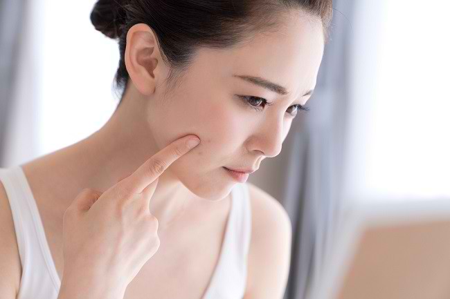 Forskellige myter, hvordan man slipper af med acne og fakta bagved
