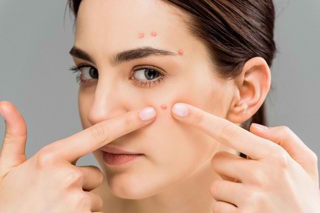 Kend forskellige måder at slippe af med acne hurtigt