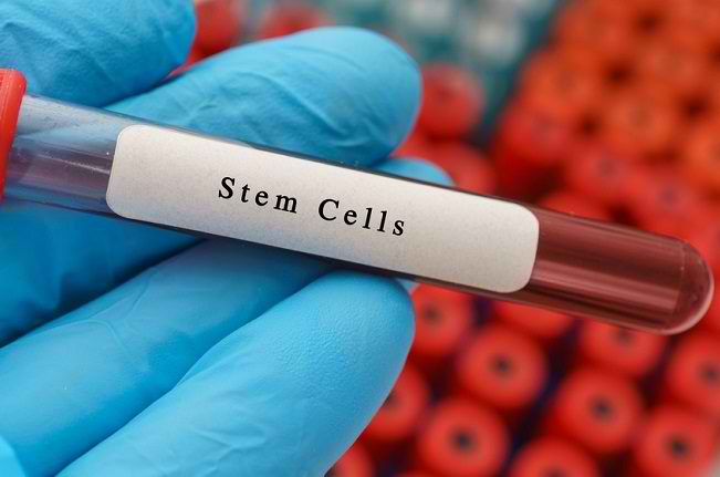 स्टेम सेल ट्रांसप्लांट, क्षतिग्रस्त कोशिकाओं को बदलने के लिए एक उपचार विधि