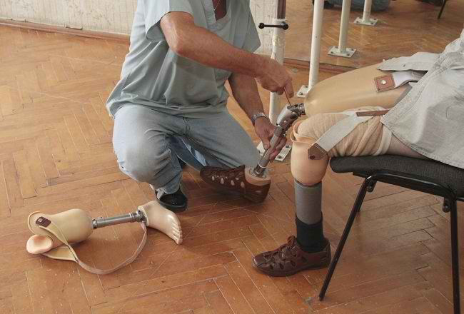 Pleje af proteser som at have rigtige fødder