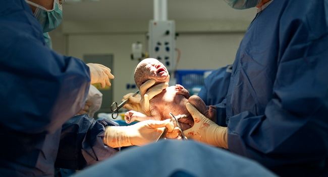 Normal Vs Caesarean Birth: These are the Benefits and Risks