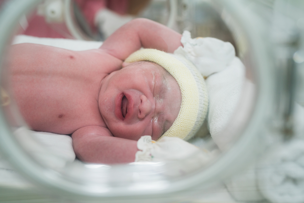 Mga Kondisyon na Nangangailangan ng Newborn Resuscitation