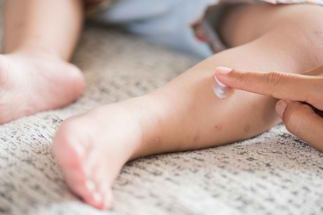 Er myggeafvisende lotion sikker for babyer?