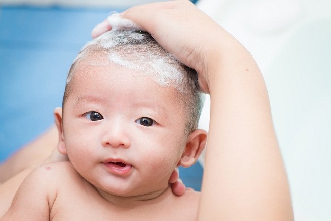 3 passos fàcils per desfer-se de la caspa al cuir cabellut del nadó