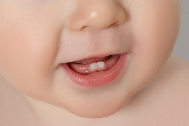 Sprendimai, kaip įveikti skundus dėl kūdikių dantų dygimo