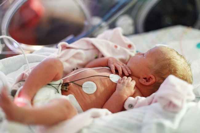 Hydrops Fetalis, en tilstand, der kan være livstruende for babyer