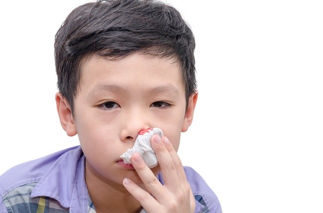 Būkite atsargūs, kai vaikai dažnai kraujuoja iš nosies