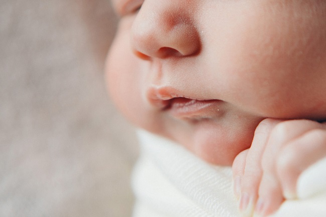 Испуцале усне код новорођенчади, да ли је опасно?