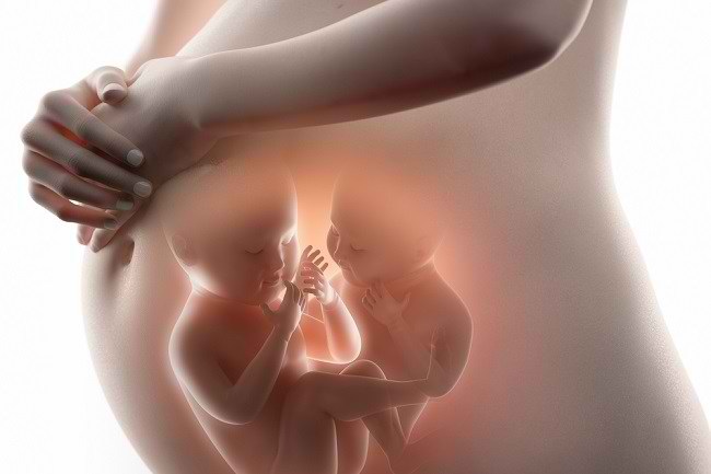 Komplikationer af tvillingegraviditet hos babyer og gravide