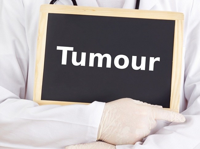 Some Commonly Used Tumor Treatments and Drugs