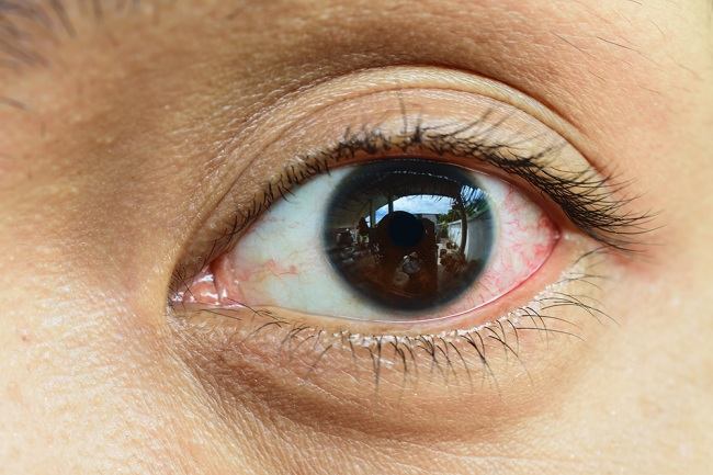 Få viden om typer, behandling og forebyggelse af smitsomme øjensmerter