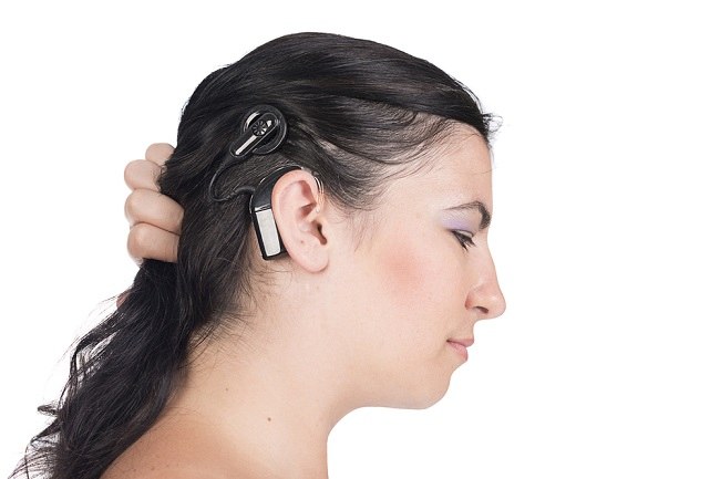 Getting to Know a Cochlear Implant for Better Hearing