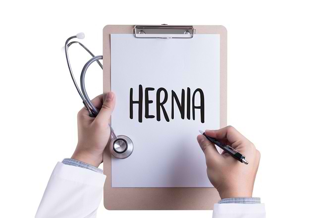 Know About Treatment After Hernia Surgery