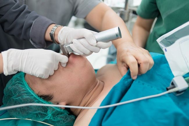 Laryngoscopy Throat Examination Procedure