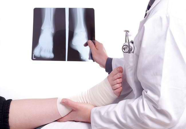 Procediment d'inserció del bolígraf per al tractament de fractures