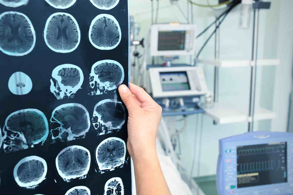 Teadke fluorestsentsiga ajukasvaja operatsiooni eeliseid ja riske