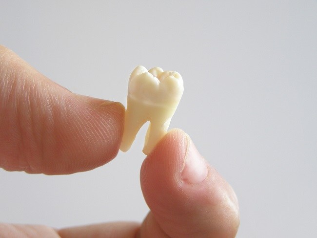 Årsager til løsnede tænder og hvordan man overvinder det
