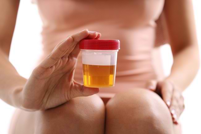 Myter om urinterapi og medicinske fakta